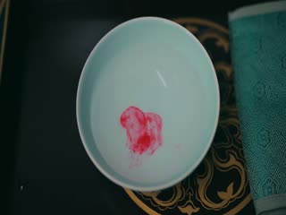 Phim Độ Hoa Niên Tập 36